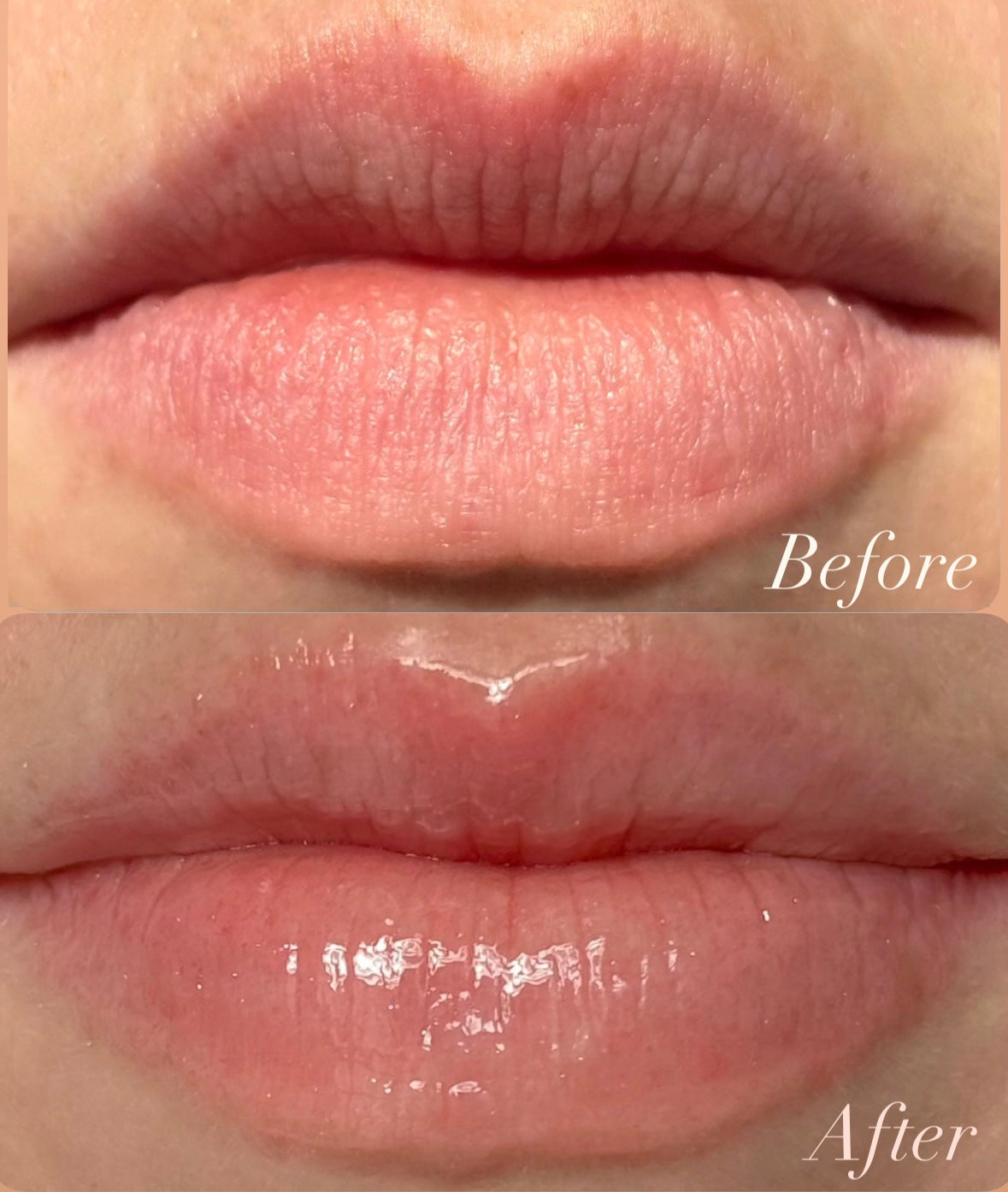 Before and after comparison of lips with a clear product application.