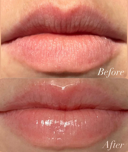 Before and after comparison of lips with a clear product application.